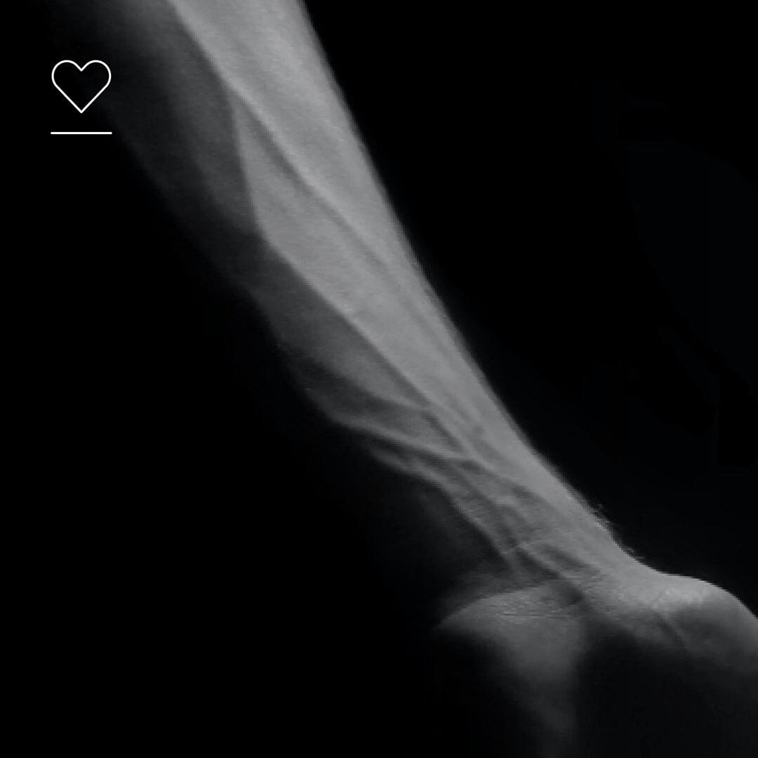 What happens to your blood vessels as you age?